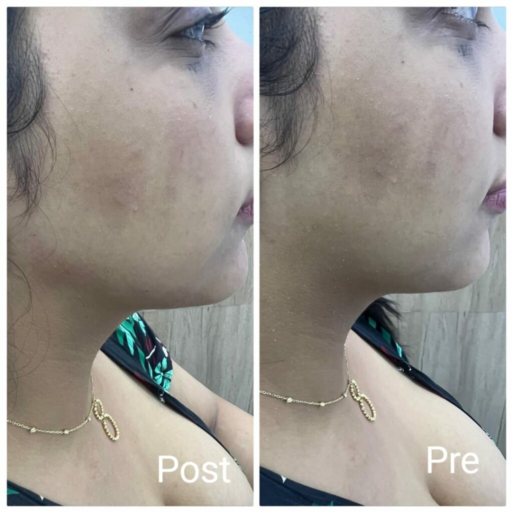 تعريض الفك في الغردقة